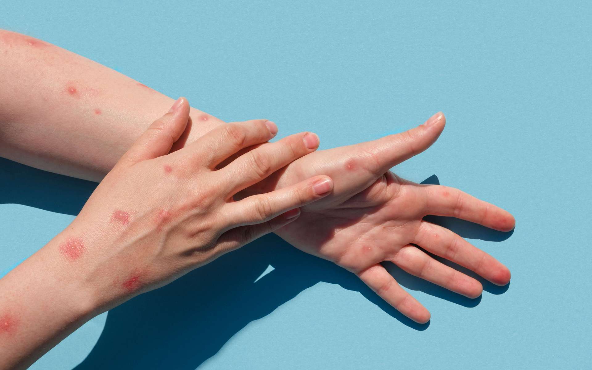 guidelines-following-the-monkeypox-outbreak